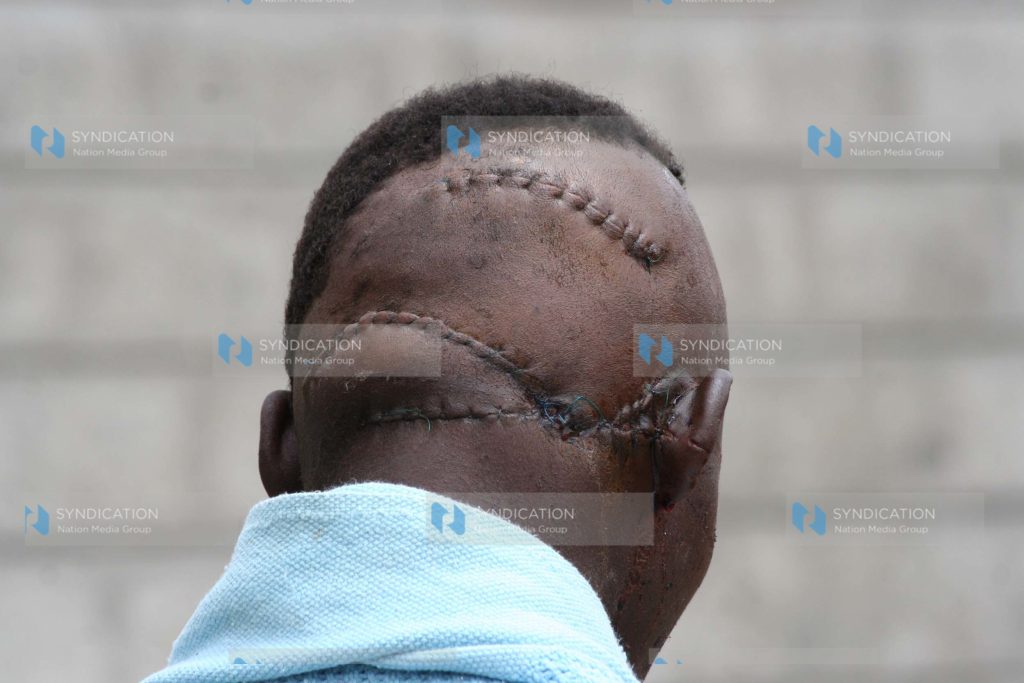 Post-election violence