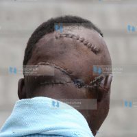 Post-election violence