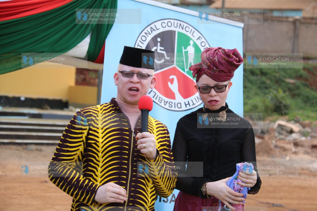 International Albinism Awareness Day